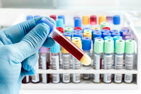 Цифровой портрет пациента: какие анализы сдавать мужчине
Цифровой портрет пациента: какие анализы сдавать мужчине